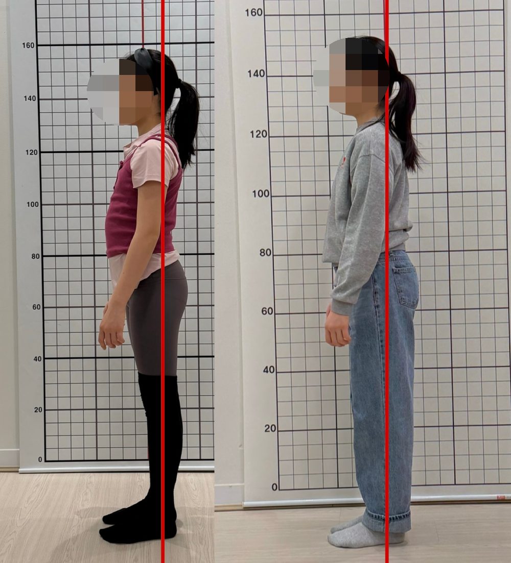초등학생 회원 자세 전후 비교