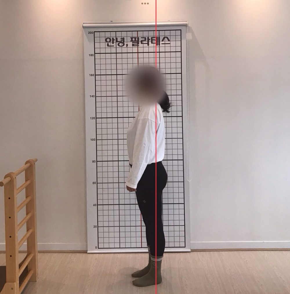 거북목·라운드숄더 회원 옆모습 자세 평가
