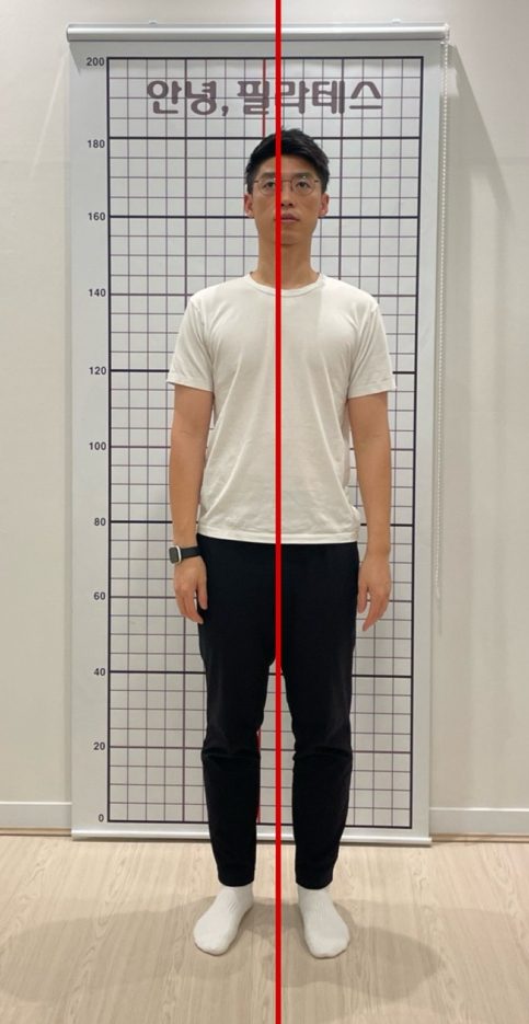 정적 평가 정면 사진